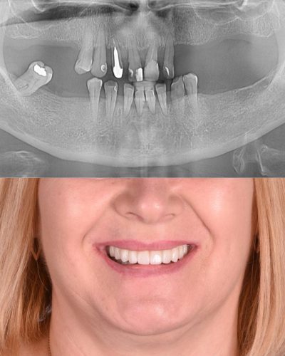 SMILE ART dr. Măriuța (9)