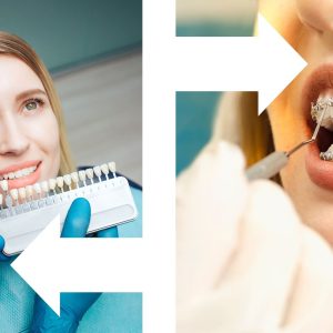 fatete sau aparat dentar